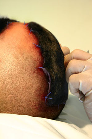 FANTASIA_DE_COMPENSACAO_RB6