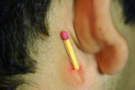 RISCO_DE_DESASSOSSEGO_06