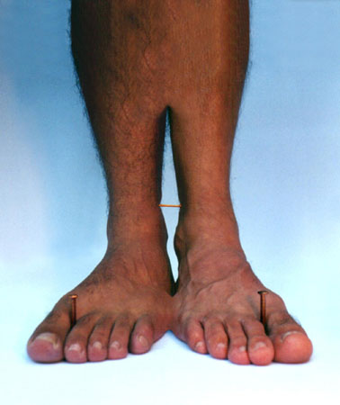 UNHA_E_CARNE_II__RODRIGO_BR